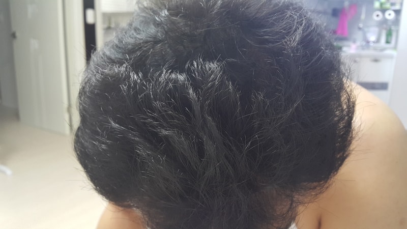 abote + midinoxil 第154天后期