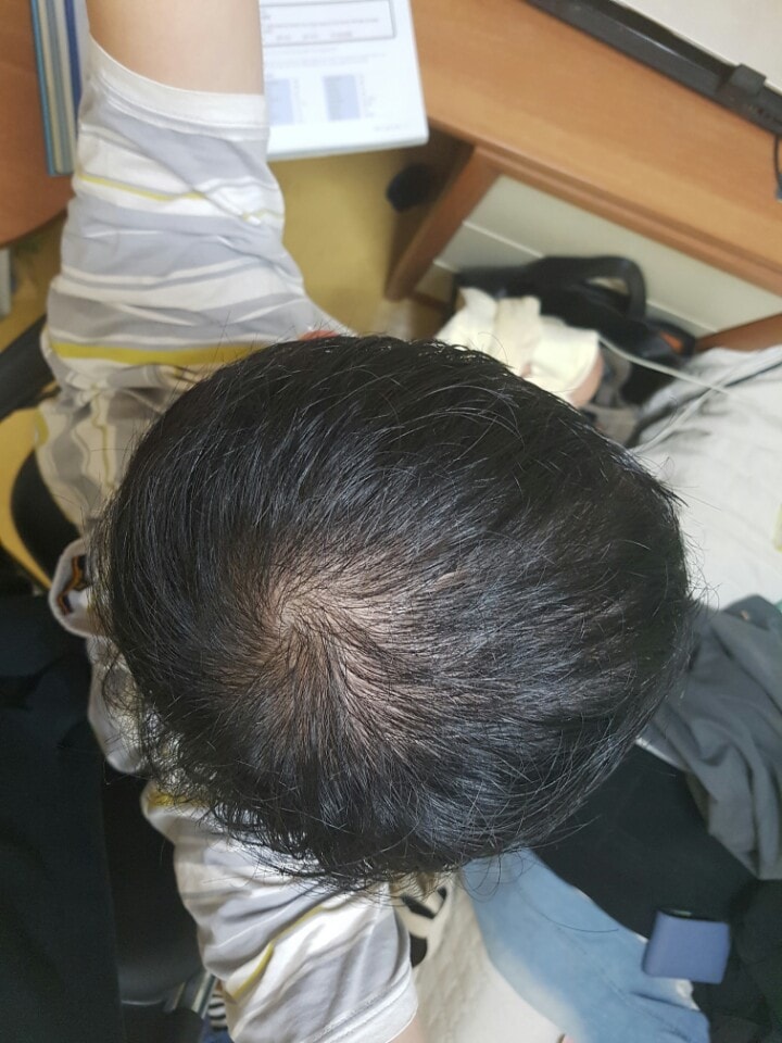 약먹은지 4개월 째