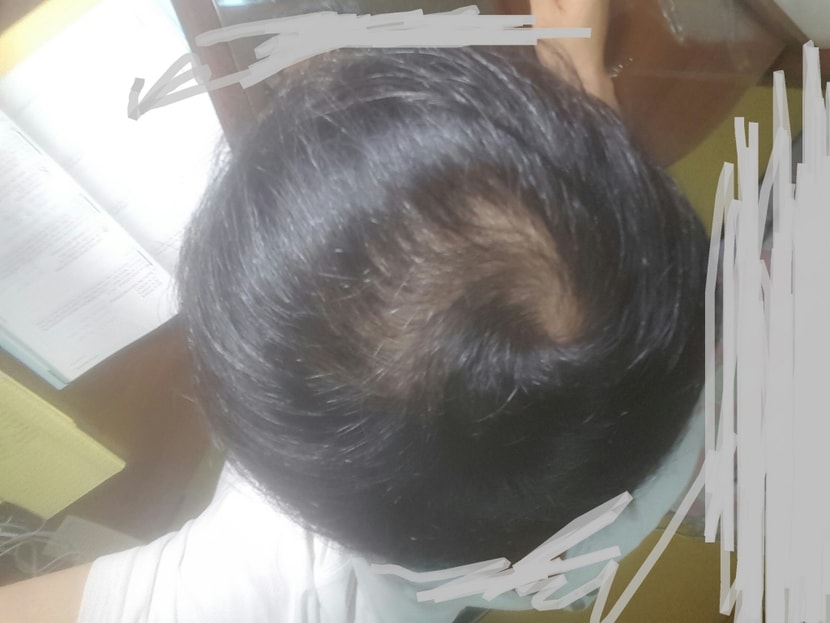 프페 6개월+ 미녹2달