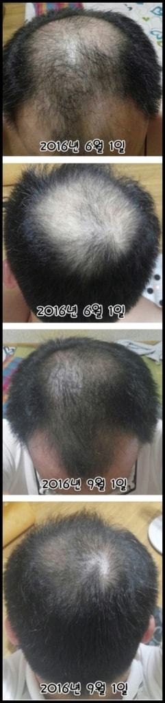 프페&미녹의 효과가 참 좋네요