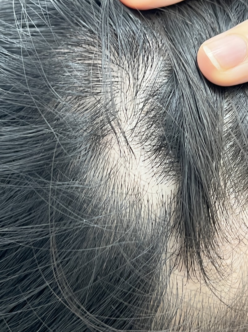 세 달 동안 판토모나 비오틴 먹어봤어요. 달라진거 같나요?