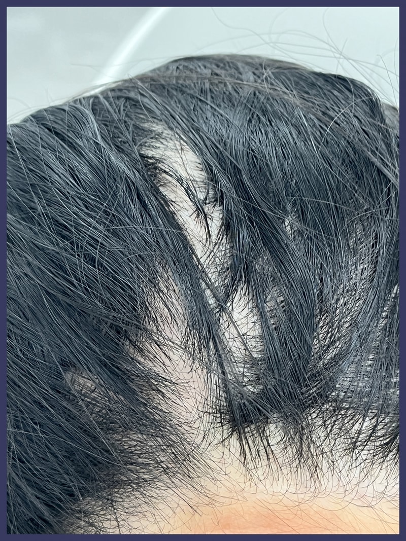 판토모나 일년 먹고 느낀 점 공유할게요