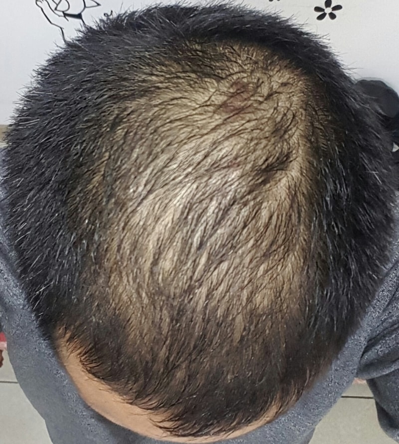 Papeavo + Kirkland 80 日后记