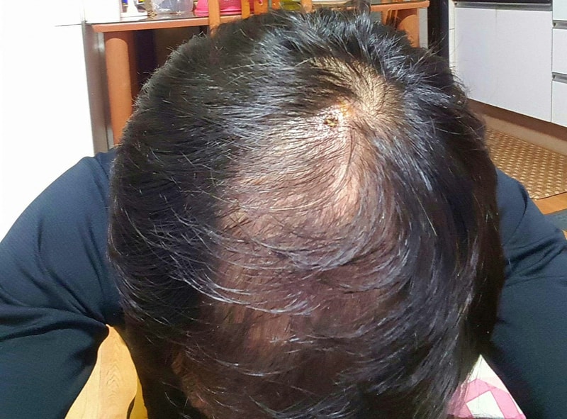프페 2달 커클 1달 후기 입니다