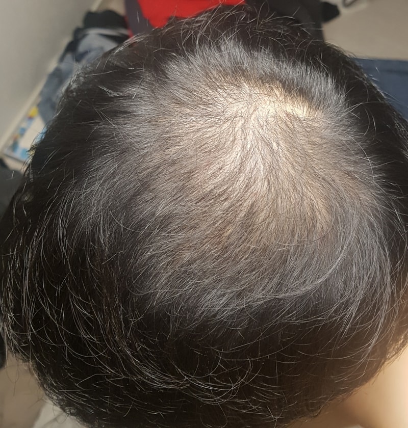 I've been eating Professionalsia for over 2 years, how does it look?