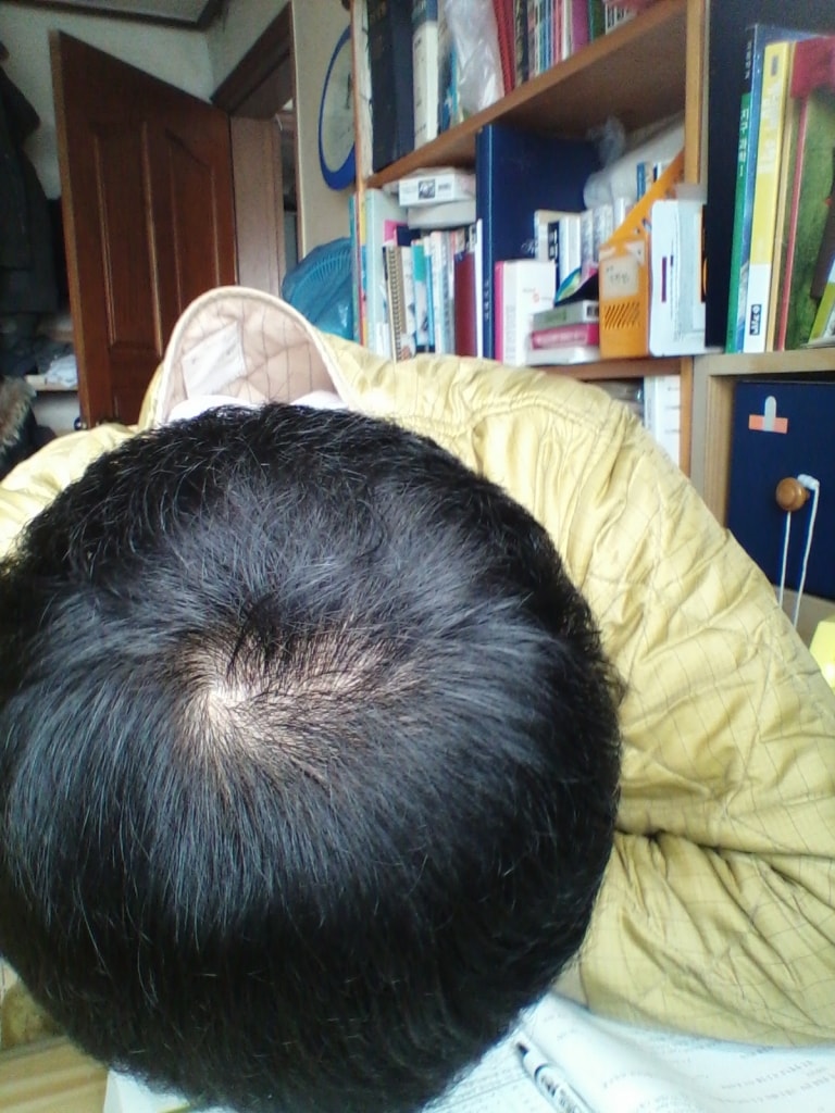 밑에 아보다트 후기올렸는데 집에서 찍은사진 이에요...