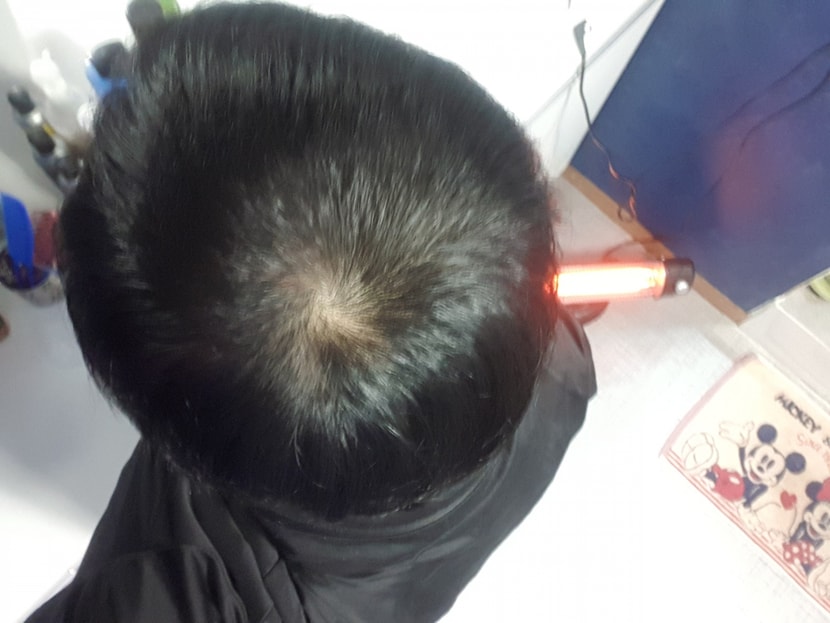 현제
