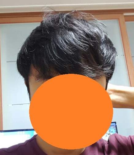 앞모습