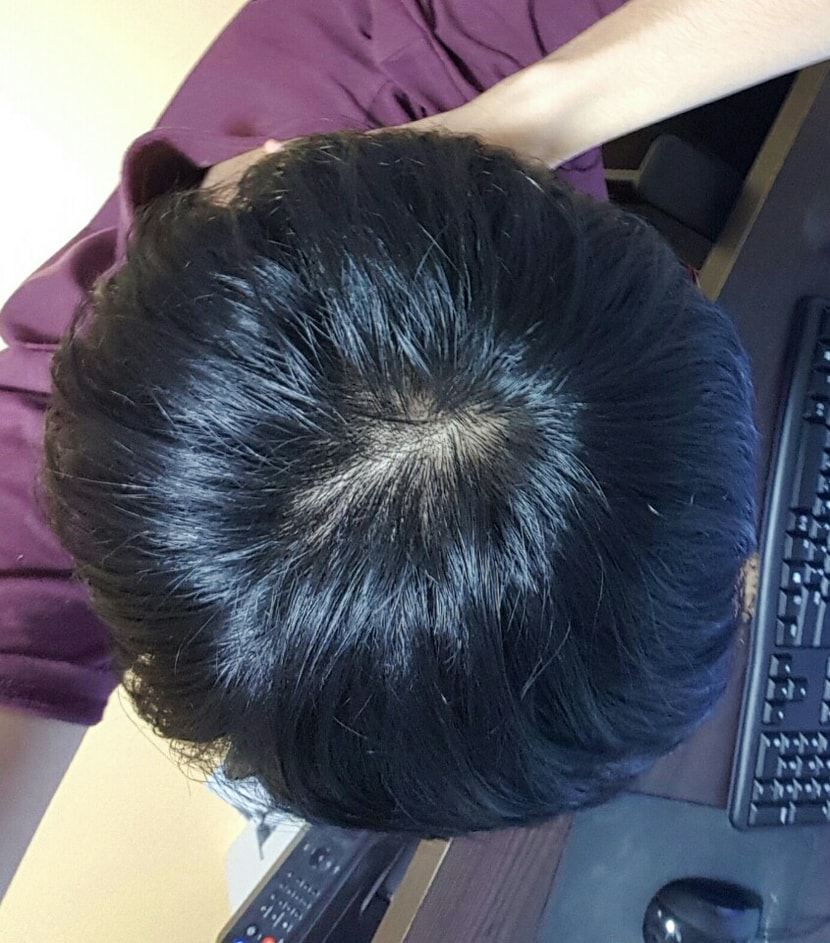 정수리