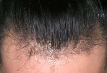 10개월