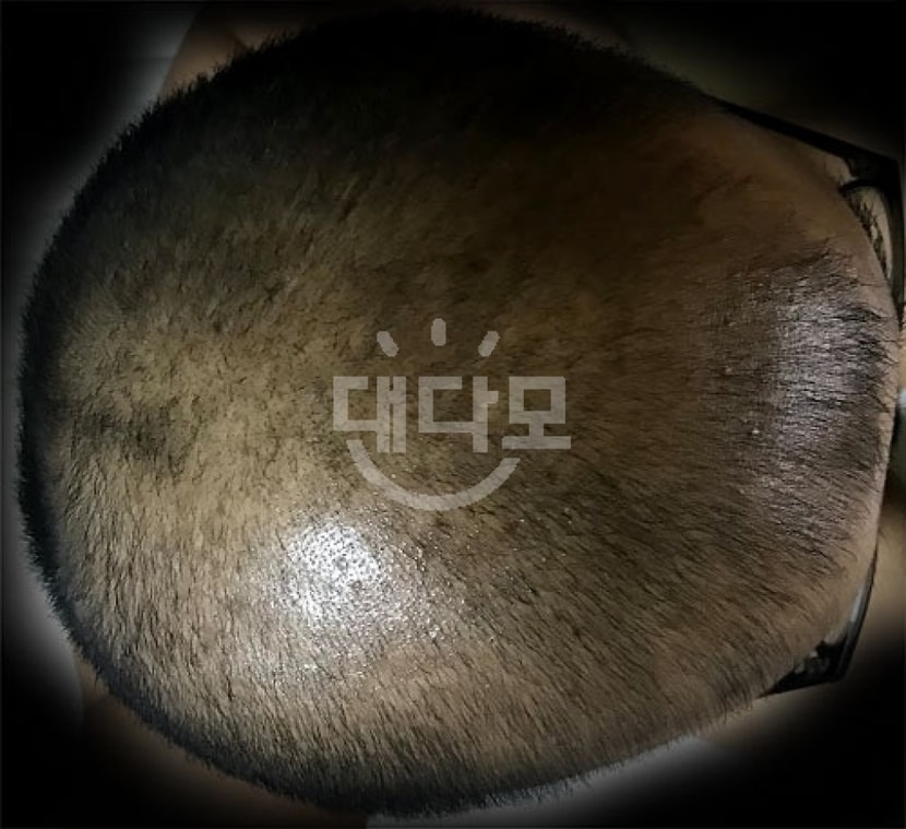3개월