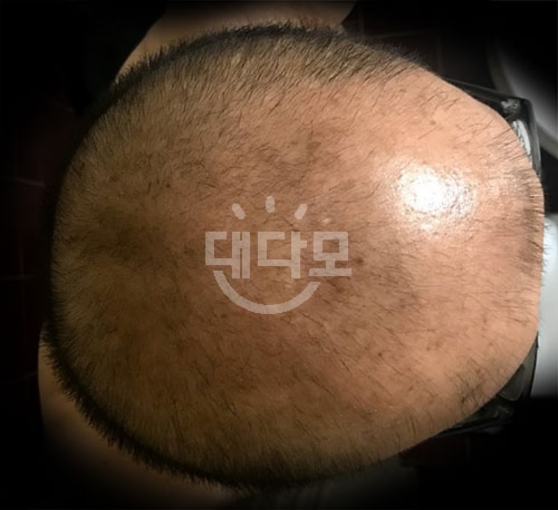 [Profesia + Minok] It's been 4 months