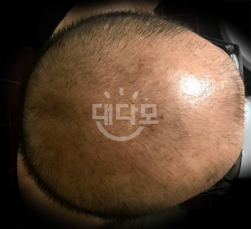 1개월