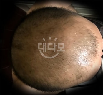 2개월