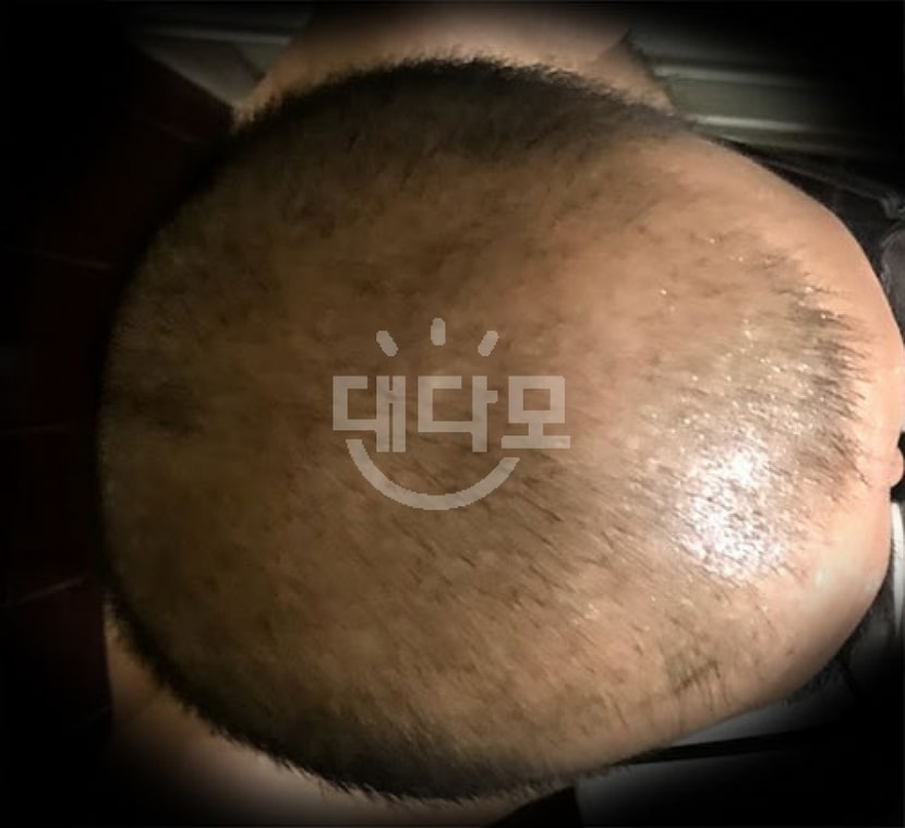 2개월