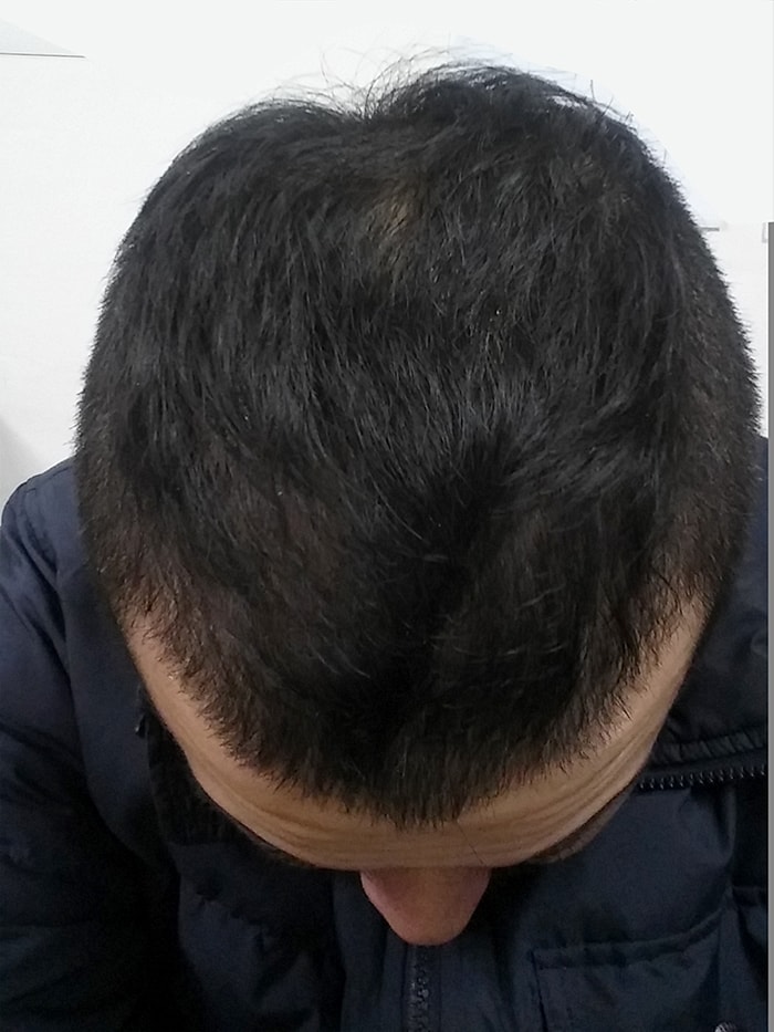 2015년 2월 25일. 한달이 채 안지났는데 신기해서 찍었습니다.