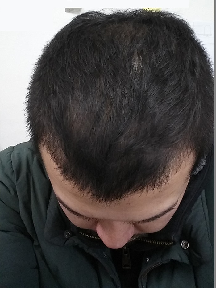 2015년 2월 6일. 효과가 있는듯 만듯 머리만 자란듯?