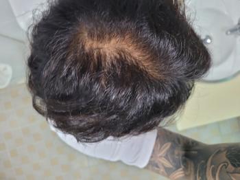 약 복용 첫째날