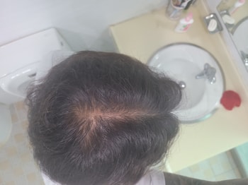 약 복용 2주째날