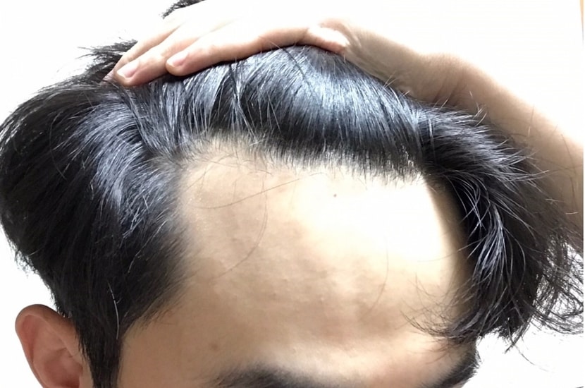현재 1