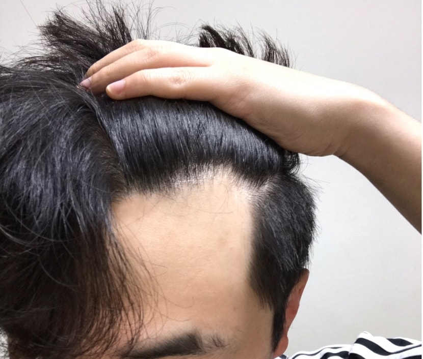 현재 2