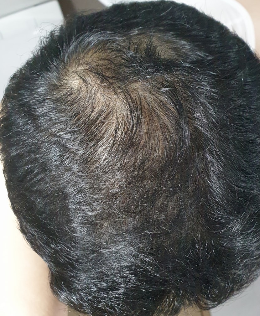 가장 최근