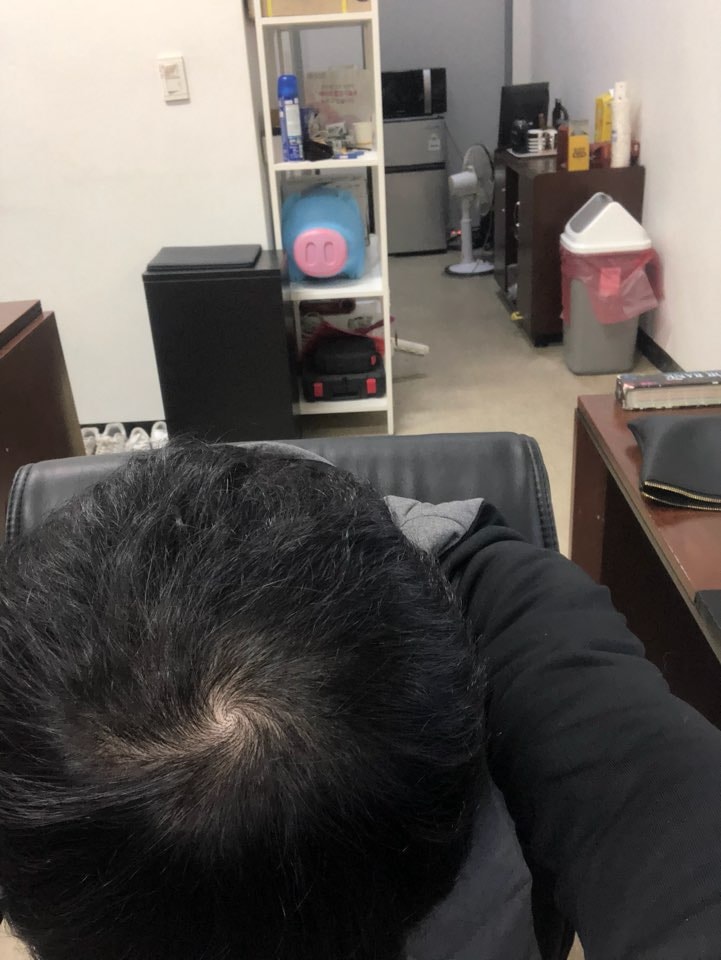 모나페시아 1개월 차 