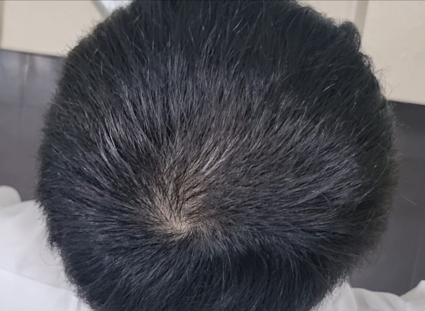 약을 복용한 후