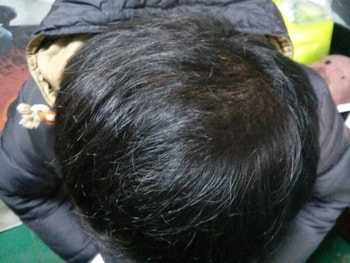 약끊은지 4 개월차 망함