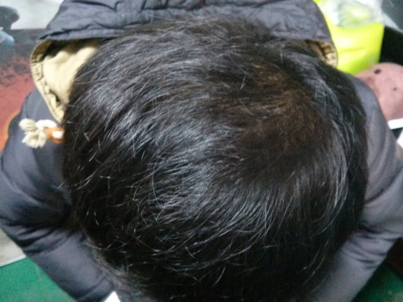 약끊은지 4 개월차 망함
