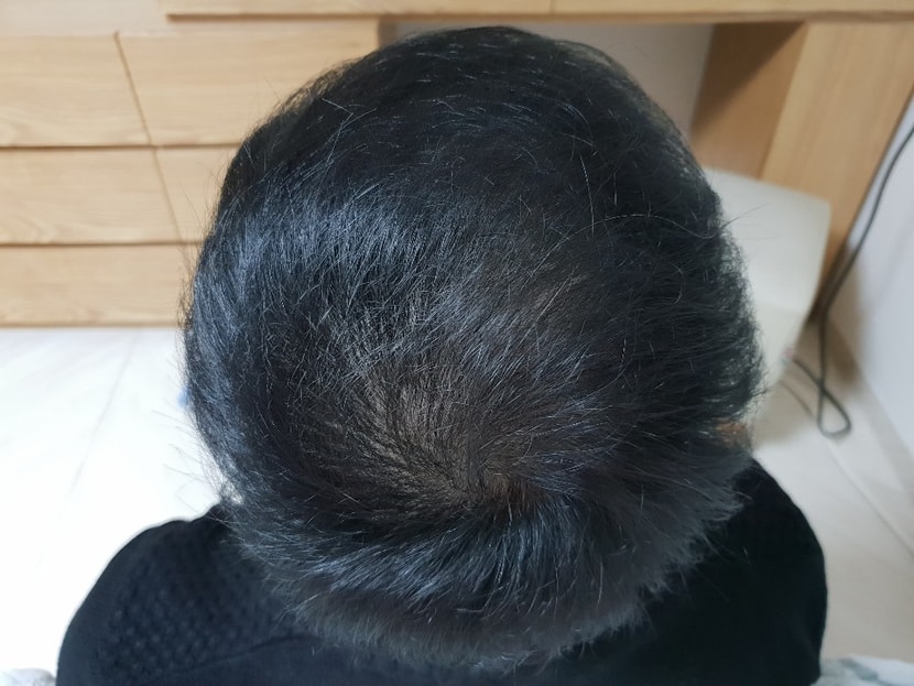 19년02월 10일 사진2(LED조명아래서)