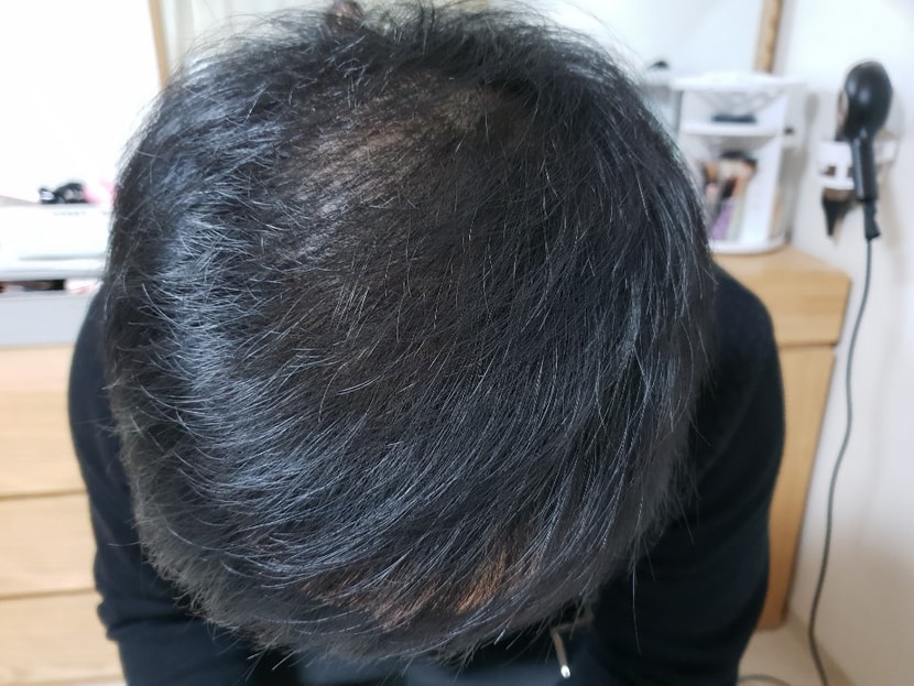 19년02월 10일 사진1LED조명아래서)