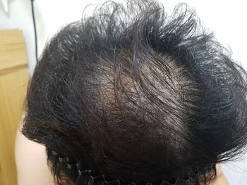 18년08월 미녹시작 전2