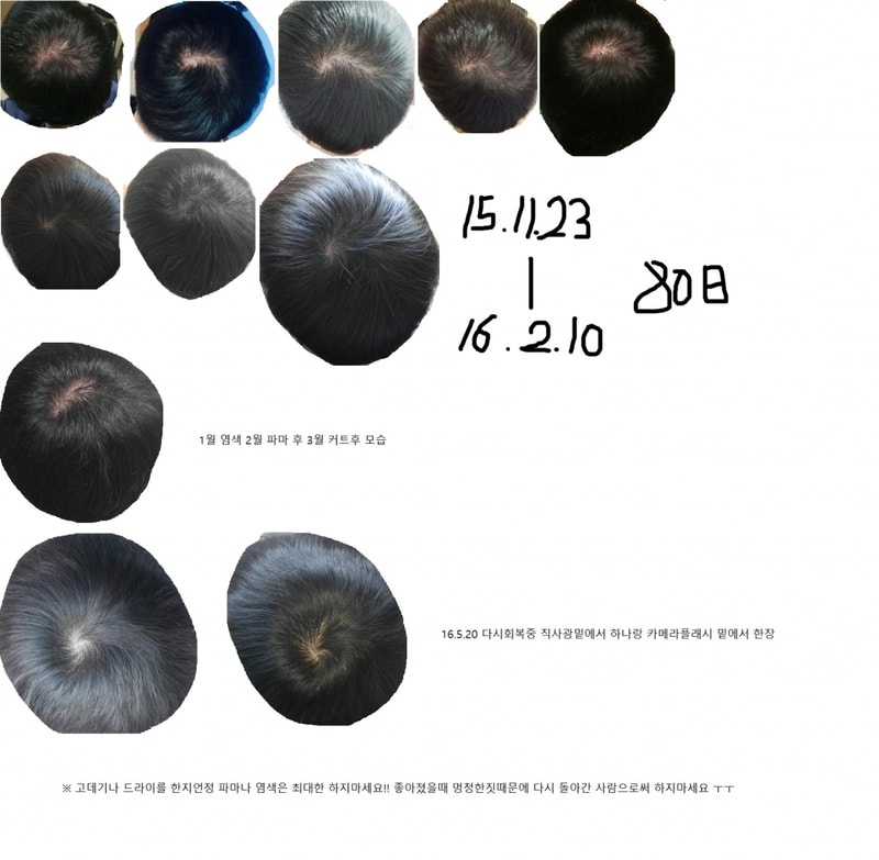 오랜만에 왔습니다 180일 후기입니다!