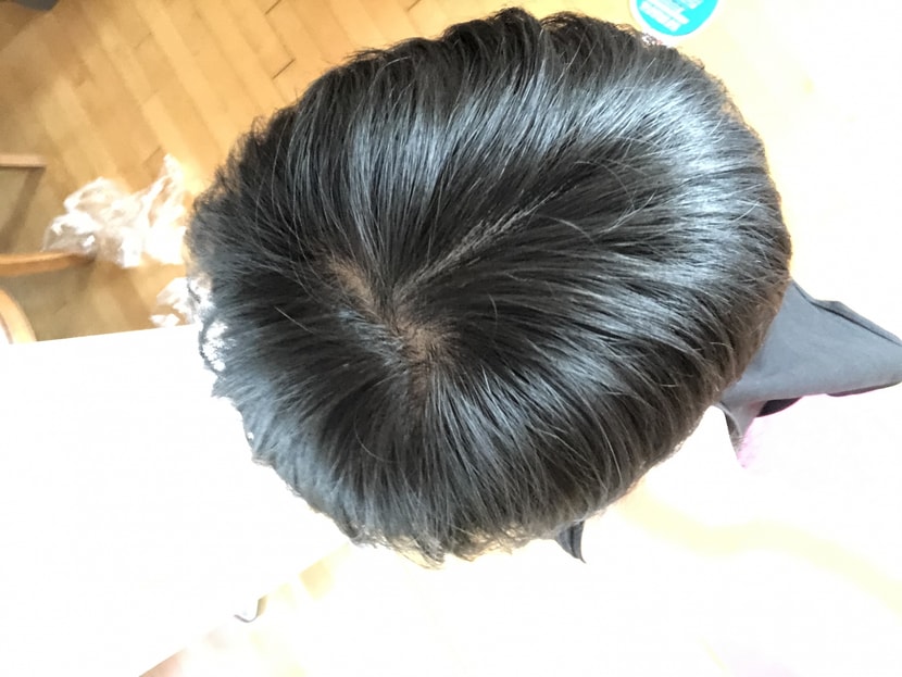 처음 머리 얇아짐 느꼈을때 작년 4월