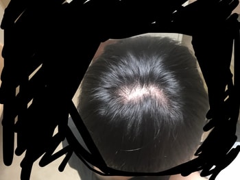 이게 오늘 아침에 빗으로 정리하고 찍은건데 차이가 없네요 당분간 미용실가서 탈밍아웃하고 잘라야겠어욬ㅋㅋㅋ
