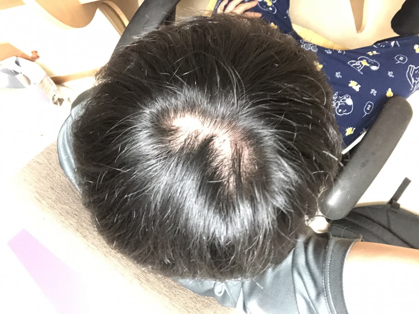 3개월차 머리자르고 더 넓어진듯.. ㅋㅋㅋ