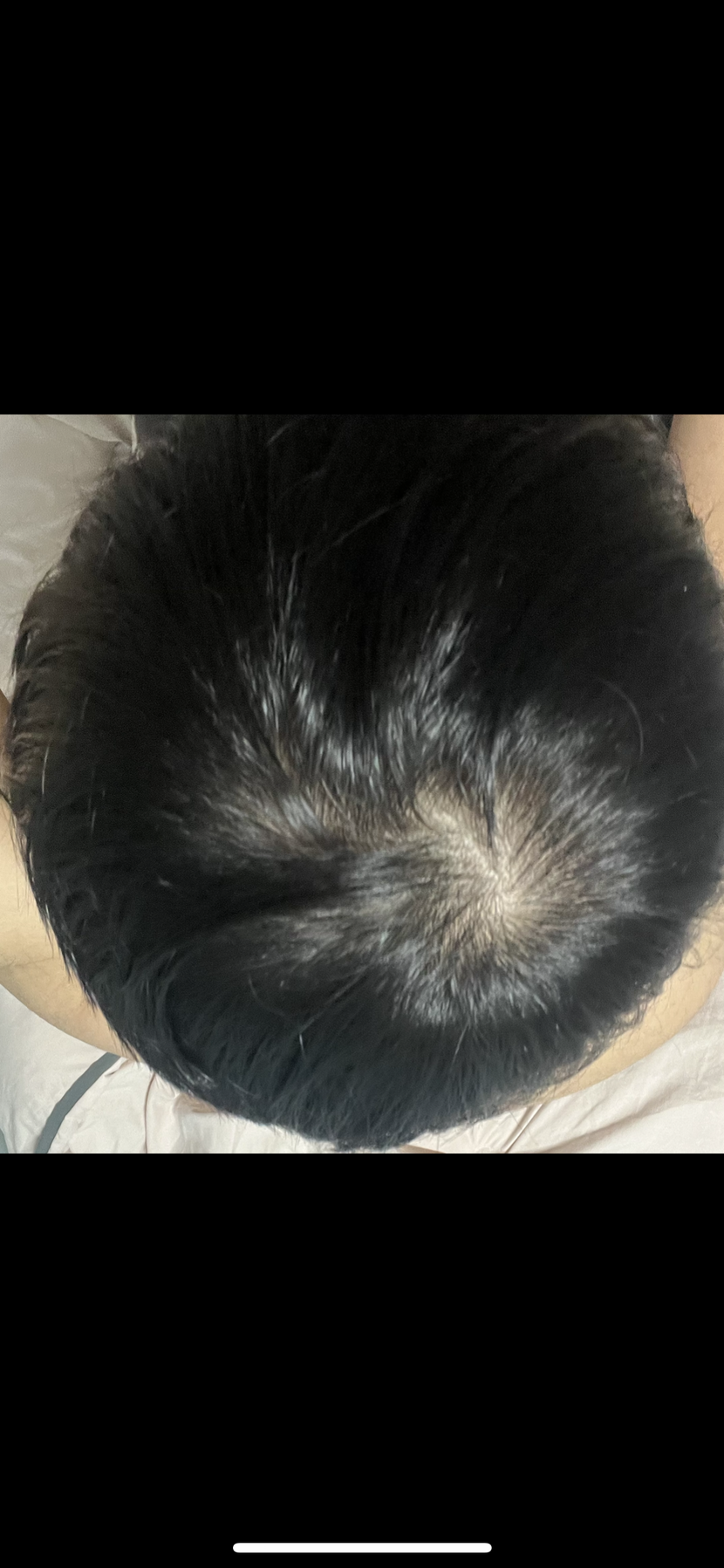 먹고 일주일