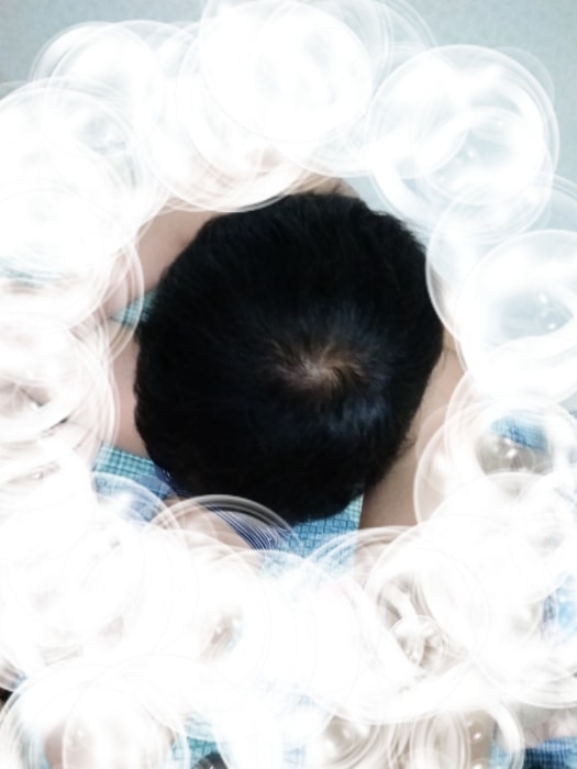 프페 미녹 8개월 사진첨부