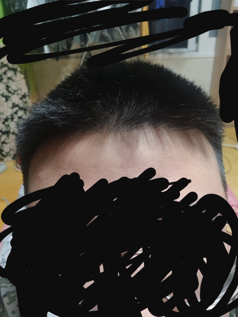 앞머리 부분 사진찍었을때
