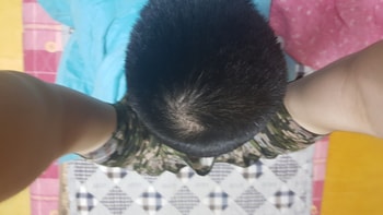 정수리