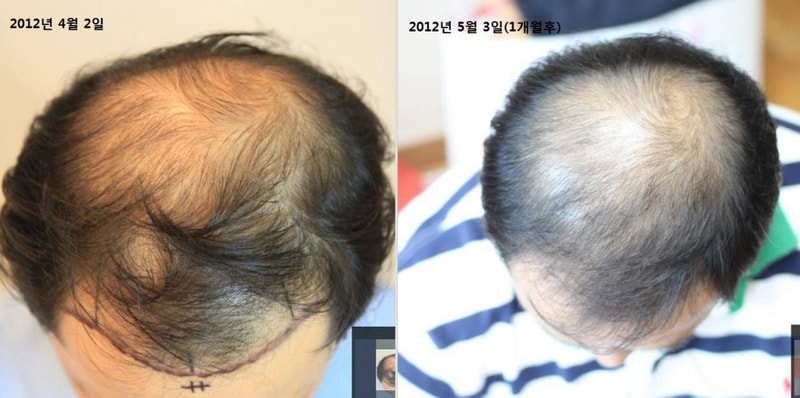 雅培3个月后记...