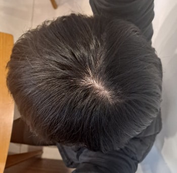 피나앰정 2달차