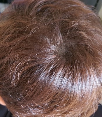 아보다트 1년 되가는...