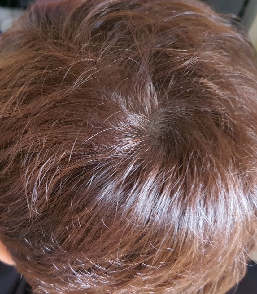 아보다트 1년 되가는...
