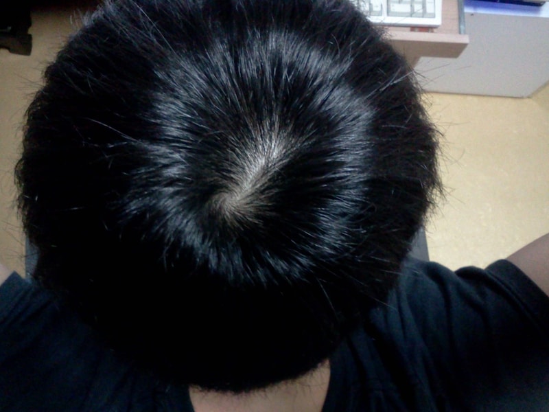 프카 먹기 시작한지가 8개월쯤 되었습니다