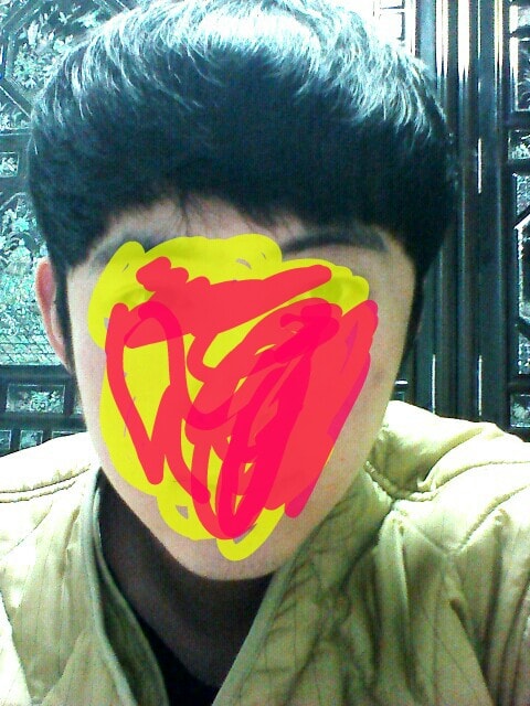 아보다트 효과 좋네요