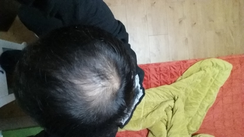 30일경과
