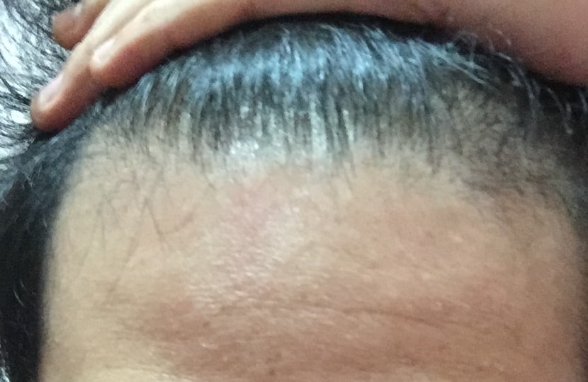 잔털은 올라오려나..