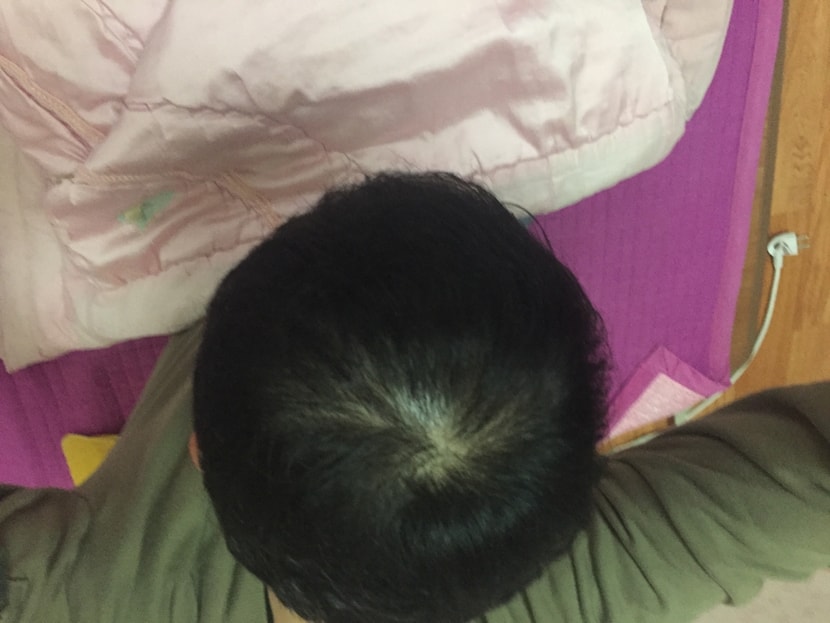 스프레이뿌리고 빛받을때